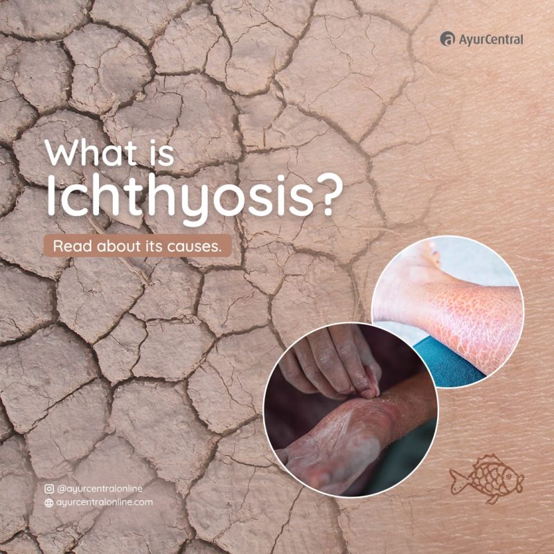 causes of dryness in your skin